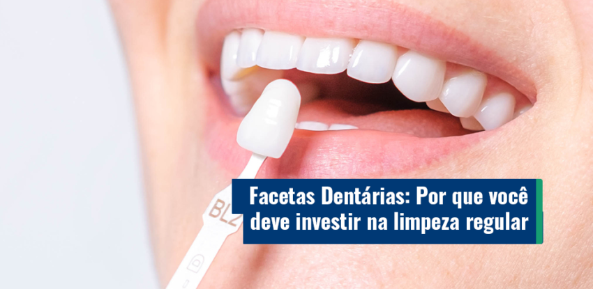 <strong>Facetas Dentárias: Por que você deve investir na limpeza regular</strong>